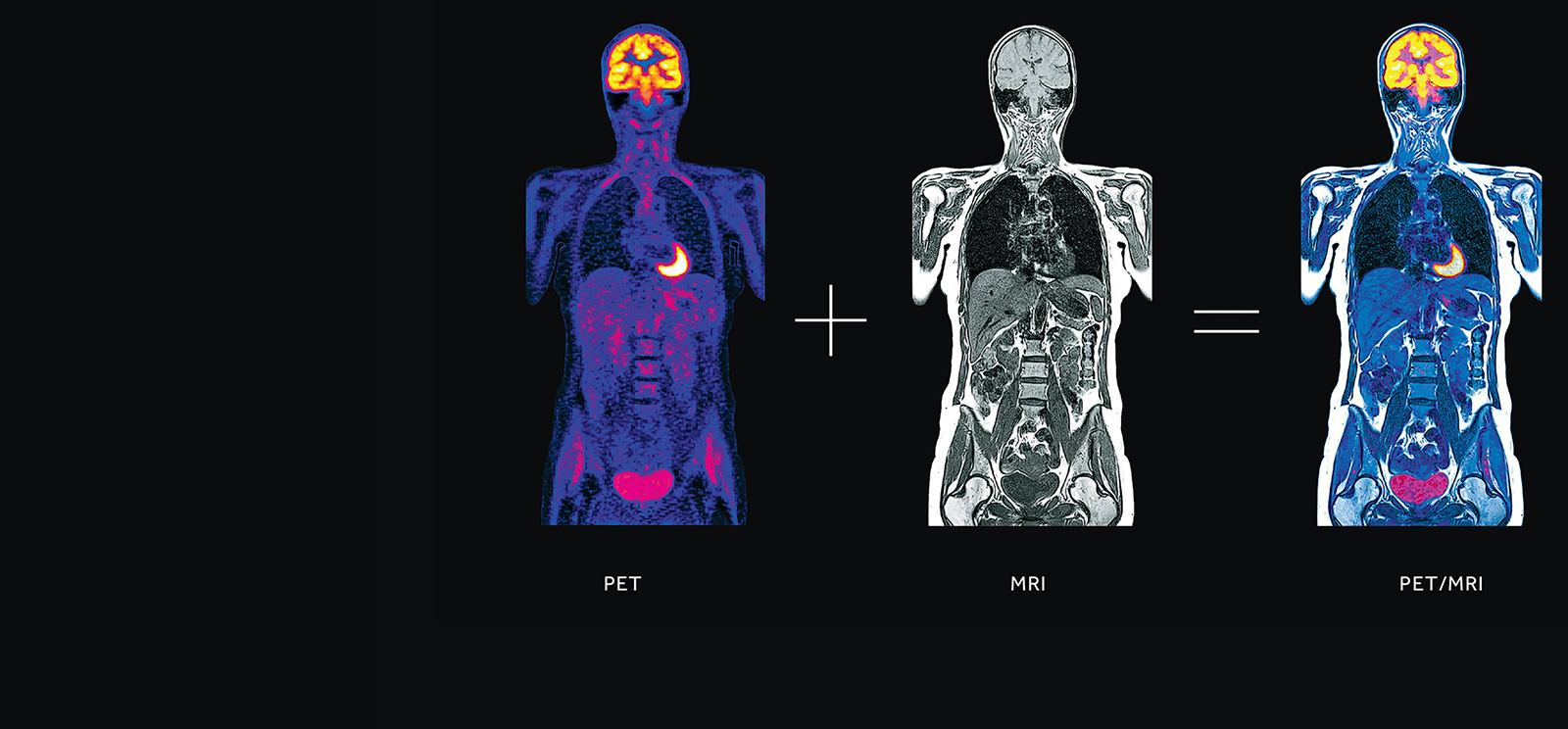 nuclear test heart medicine Services Stony Medicine Imaging Brook