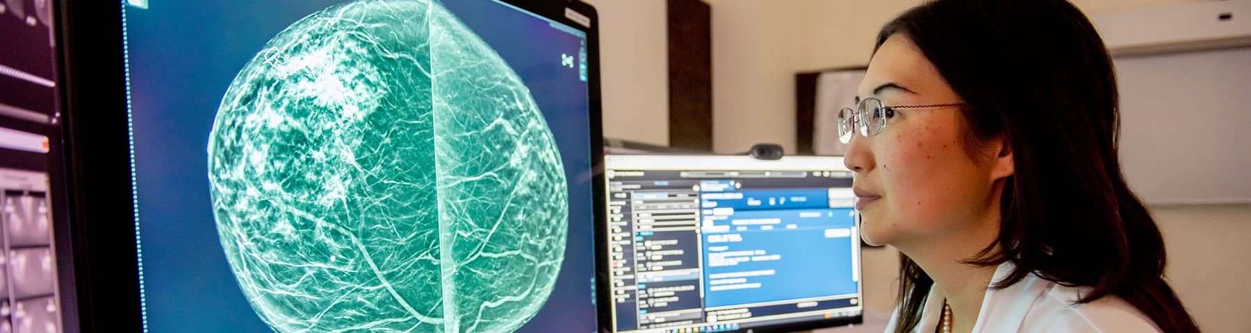 Radiologist reviewing a breast imaging scan on a computer monitor